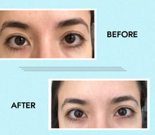 Load image into Gallery viewer, New JuvaEye Red Light Therapy Dark Circles Baggy Eye Care Mask with Shiatsu Massage and Airbag Vibration Therapy