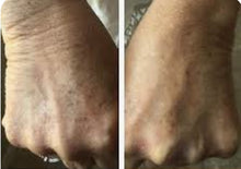 Load image into Gallery viewer, New JuvaGlove 7 Photon LED Beauty Skincare Pain Relief Glove