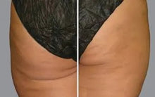 Load image into Gallery viewer, JuvaShape XL Red Light Therapy Weight Loss Pain Relief Belt