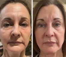 Load image into Gallery viewer, New JuvaX PRO Multi LED Skincare Mask with Microcurrent