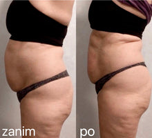 Load image into Gallery viewer, New ‘HotCryo’ 360° Dual Cryolipolysis And Thermotherapy Fat Reduction System