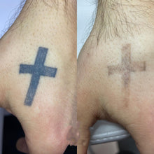 Load image into Gallery viewer, New JuvaRase Tattoo Removal and Skin Rejuvenation Machine