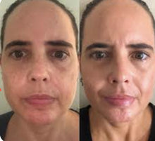 Load image into Gallery viewer, New JuvaX PRO Multi LED Skincare Mask with Microcurrent