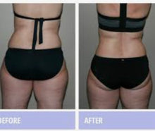 Load image into Gallery viewer, JuvaShape XL Red Light Therapy Weight Loss Pain Relief Belt