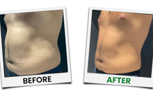 Load image into Gallery viewer, New Limelight 360° 6D Green Laser Lipo System for Non Surgical Fat Removal