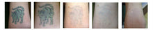 Load image into Gallery viewer, New JuvaRase Tattoo Removal and Skin Rejuvenation Machine