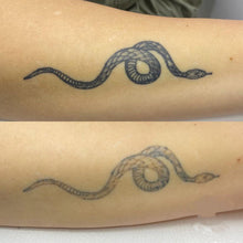 Load image into Gallery viewer, New JuvaRase Tattoo Removal and Skin Rejuvenation Machine