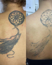 Load image into Gallery viewer, New JuvaRase Tattoo Removal and Skin Rejuvenation Machine