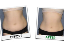 Load image into Gallery viewer, New Limelight 360° 6D Green Laser Lipo System for Non Surgical Fat Removal