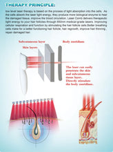 Load image into Gallery viewer, New LocksLaze Laser Diode Hair Restoration Growth Comb