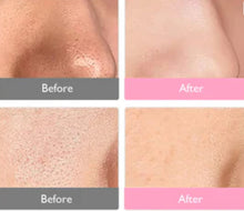 Load image into Gallery viewer, New JuvaMask 3D Silicone Rechargeable Portable 4 Wavelength LED Infrared Light Therapy Skincare Mask with LED Neck Gaiter