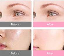 Load image into Gallery viewer, New JuvaMask 3D Silicone Rechargeable Portable 4 Wavelength LED Infrared Light Therapy Skincare Mask with LED Neck Gaiter