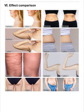 Load image into Gallery viewer, New MicroCool Waves ® NON INVASIVE FACE & BODY SCULPTING SYSTEM