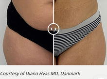 Load image into Gallery viewer, New MicroCool Waves ® NON INVASIVE FACE & BODY SCULPTING SYSTEM