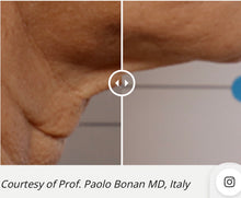 Load image into Gallery viewer, New MicroCool Waves ® NON INVASIVE FACE & BODY SCULPTING SYSTEM