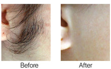 Load image into Gallery viewer, New JuvaLase 2 in 1 Professional Hair Removal Skin Rejuvenation Home Use Portable Laser Device