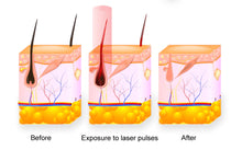 Load image into Gallery viewer, New JuvaLase 2 in 1 Professional Hair Removal Skin Rejuvenation Home Use Portable Laser Device