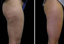 Load image into Gallery viewer, 2024 JuvaShape Android 6 Technology Non Surgical Fat Reduction Body Contouring Cellulite Removal Cosmetic System