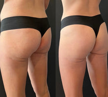 Load image into Gallery viewer, New 2026 JuvaBun HEMG® (High Efficiency Muscle Gain) Butt Lifting Sculpting Contouring Fat Burning Chair