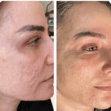 Load image into Gallery viewer, 2026 JuvaPlume Premier Multi Plasma Skincare Tool