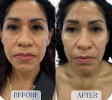 Load image into Gallery viewer, 2026 JuvaPlume Premier Multi Plasma Skincare Tool