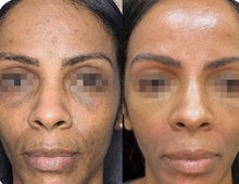 Load image into Gallery viewer, 2026 JuvaPlume Premier Multi Plasma Skincare Tool