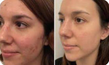 Load image into Gallery viewer, New AquaLift Hydrafacial Electroporation Needless Mesotherapy Skincare Facial Beauty System