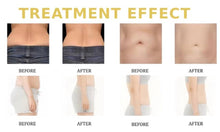 Load image into Gallery viewer, New Roller Ball 360° Automatic Micro Vibration, Infrared and Lymphatic Drainage Massage Therapy System with Red Light Therapy