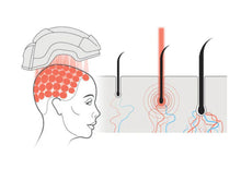 Load image into Gallery viewer, New JuvaHair Professional Laser Hair Growth Scalp Health Helmet