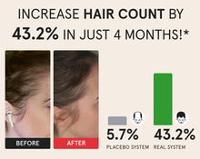 Load image into Gallery viewer, New JuvaHair Professional Laser Hair Growth Scalp Health Helmet