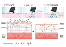Load image into Gallery viewer, Glowskin Hot Springs O+ 2 in 1 Carbon Oxygen Facial Beauty Machine