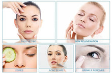 Load image into Gallery viewer, Glowskin Hot Springs O+ 2 in 1 Carbon Oxygen Facial Beauty Machine