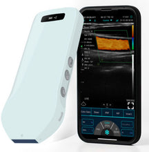 Load image into Gallery viewer, Butterfly linear ultrasound probe color Doppler cosmetic surgery three easy-to-use activation buttons, with the linear ultrasound probe frequency set between 10-14mhz and 192 colorful elements.
* Color Doppler linear probe can quickly examine arteries, blood vessels, MSK, etc.
* Multi-system platform
Connect Android/IOS/Windows Smartphone, tablet, PC.
* Easy to operate and carry
Small size, light weight 200g~240g,
* Wireless use.
* High-definition image
192 elements
* 4-level image optimization