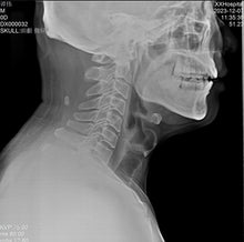 Load image into Gallery viewer, JuvaRay Mobile Handheld Digital X Ray Generator with Wireless Flat Panel Detector
