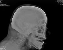 Load image into Gallery viewer, JuvaRay Mobile Handheld Digital X Ray Generator with Wireless Flat Panel Detector