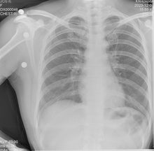 Load image into Gallery viewer, JuvaRay Mobile Handheld Digital X Ray Generator with Wireless Flat Panel Detector