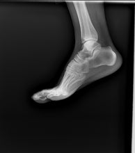 Load image into Gallery viewer, JuvaRay Mobile Handheld Digital X Ray Generator with Wireless Flat Panel Detector