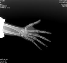 Load image into Gallery viewer, JuvaRay Mobile Handheld Digital X Ray Generator with Wireless Flat Panel Detector