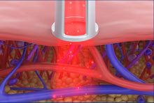 Load image into Gallery viewer, New JuvaVet Class IV Therapeutic Laser For Dogs Cats Horses