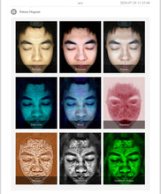 Load image into Gallery viewer, JuvaScan Intelligent 3D AI Real Time Skin Analysis System with Included 10th Generation IPAD