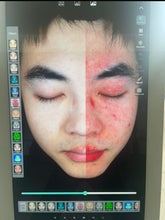 Load image into Gallery viewer, JuvaScan Intelligent 3D AI Real Time Skin Analysis System with Included 10th Generation IPAD