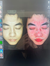 Load image into Gallery viewer, JuvaScan Intelligent 3D AI Real Time Skin Analysis System with Included 10th Generation IPAD