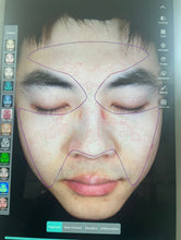 Load image into Gallery viewer, JuvaScan Intelligent 3D AI Real Time Skin Analysis System with Included 10th Generation IPAD