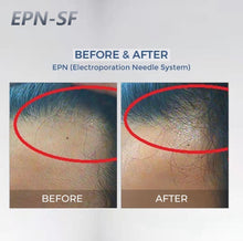 Load image into Gallery viewer, 2025 EPNdermapen Pen Wireless Professional Home Use Microneedling Skincare Pen with Electroporation