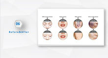 Load image into Gallery viewer, JuvaInk Home Use Portable 2 in 1 Tattoo Removal and Skin Rejuvenation 3 Wavelength Laser
