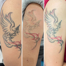 Load image into Gallery viewer, JuvaInk Home Use Portable 2 in 1 Tattoo Removal and Skin Rejuvenation 3 Wavelength Laser