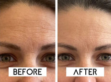 Load image into Gallery viewer, JuvaVeil Eye Recovery Pro Infrared Beauty Mask