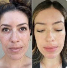 Load image into Gallery viewer, Dr. Pen M8S Elite Microneedling Pen