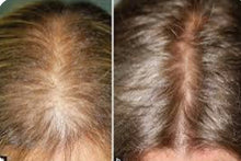 Load image into Gallery viewer, Dr. Pen M8S Elite Microneedling Pen