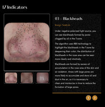 Load image into Gallery viewer, 2025 JuvaMap AI 17 Indicator 3D Skin Analyzer with Included 13.3” Android Tablet